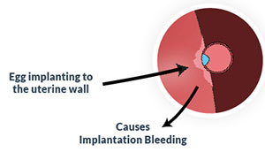 spotting pregnant implantation bleeding